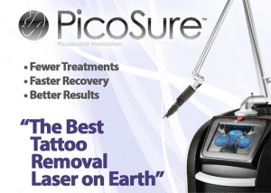 picosure-laser-tattoo-removal